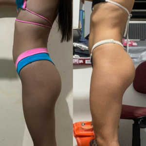 antes e depois Gabriela Caetano (1)